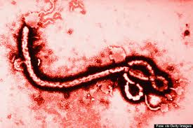 A picture of the deadly Ebola virus. 